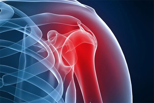 bol u ramenu zbog osteoartritisa