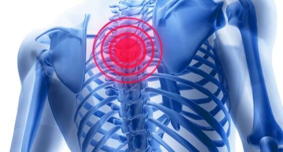 Liječenje osteohondroze torakalne kralježnice